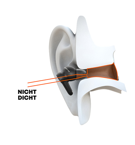 beyerdynamic - AMIRON 100 bowl shaped Ear Tips