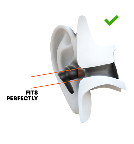 beyerdynamic AMIRON100 Eartips bowl shaped